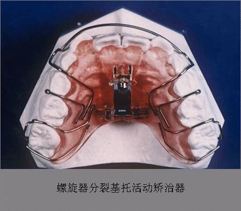 mk体育下载